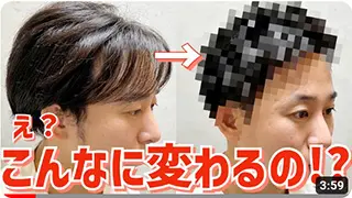 【薄毛】アップバングでM字ハゲをカバー！【徹底解説】