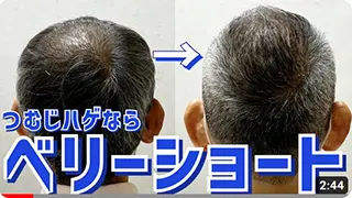 【薄毛】カットで若返る！【M字・つむじハゲ】