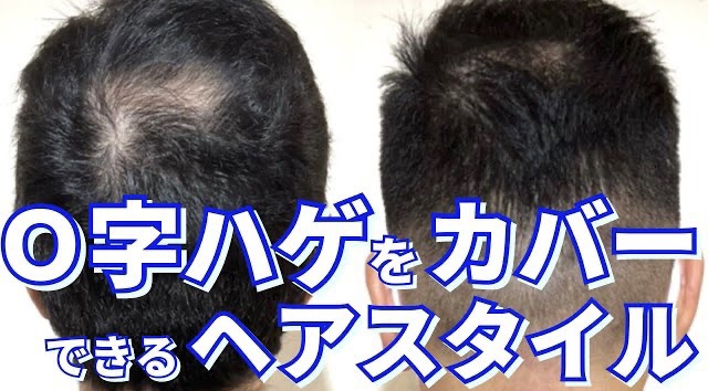 透ける頭頂部をカバーするヘアスタイル Relive吉祥寺 薄毛に悩む男性のための完全個室美容室