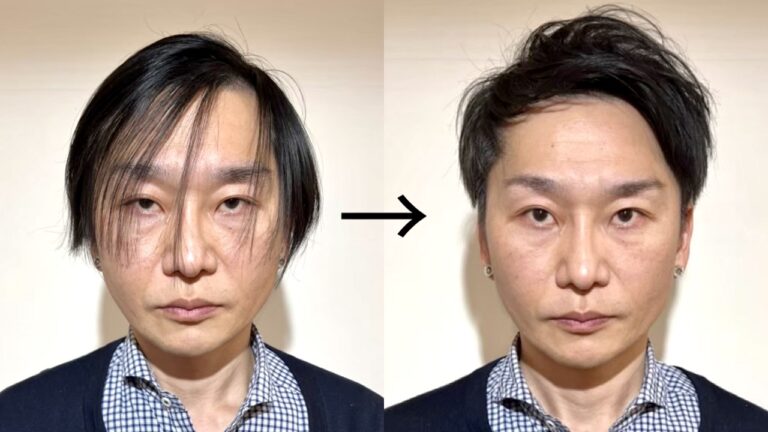 薄毛専門美容師が選ぶ|M字ハゲに似合う髪型 薄毛に悩む男性の為の美容室ならRELIVE - 薄毛に悩む男性のための完全個室美容室