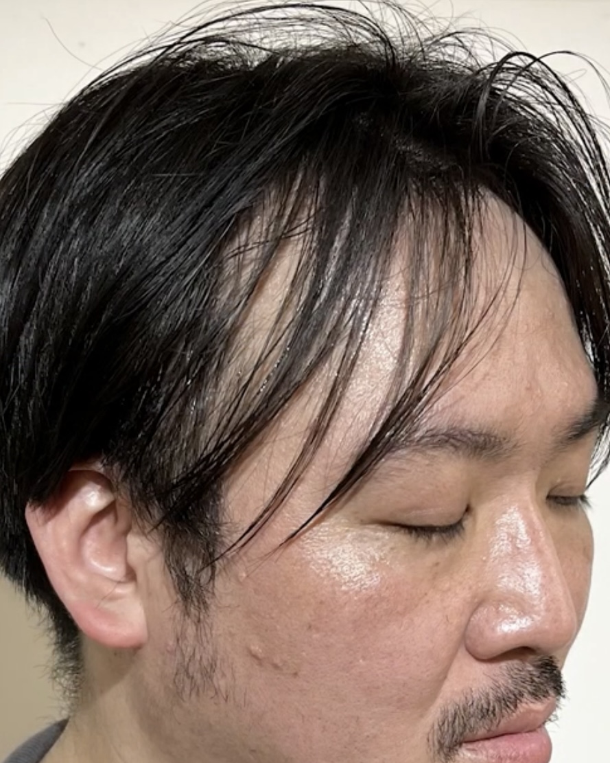 若ハゲでも似合う髪型12選!男性の若ハゲをかっこよく見せるポイントや改善方法も解説 薄毛に悩む男性の為の美容室ならRELIVE - 薄毛に悩む ...
