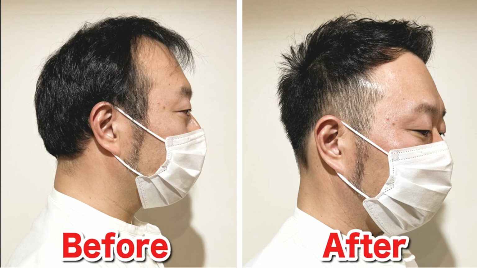 はげの基準は?前髪からはげてくる原因や主な判断基準・見分け方を解説! 薄毛に悩む男性の為の美容室ならRELIVE - 薄毛に悩む男性のための ...