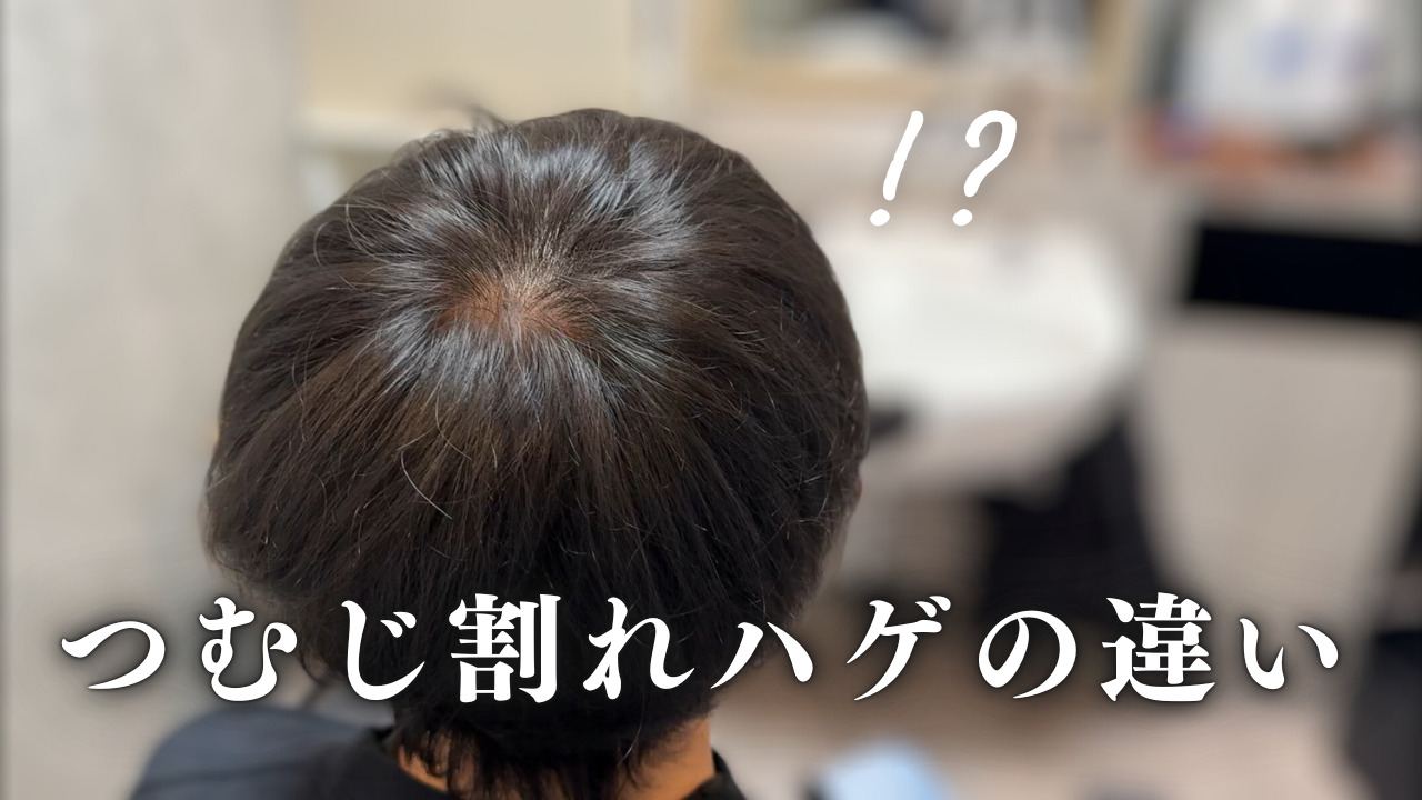 つむじ ない 人