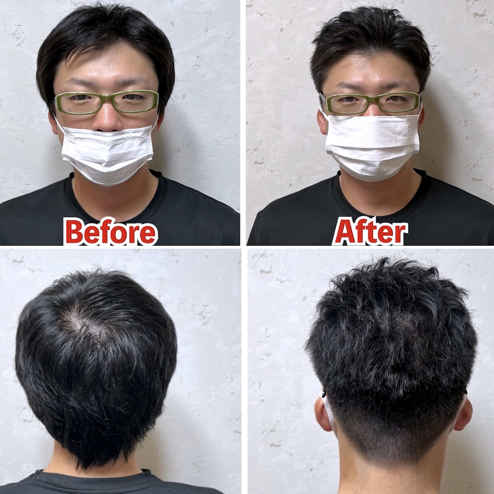 後頭部がはげる原因は?つむじはげとの違いや改善・対策方法 薄毛に悩む男性の為の美容室ならRELIVE - 薄毛に悩む男性のための完全個室美容室