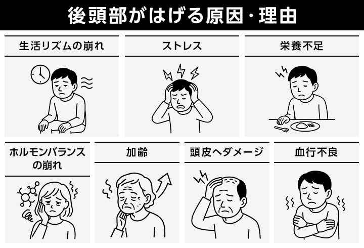 後頭部がはげる原因は?つむじはげとの違いや改善・対策方法 薄毛に悩む男性の為の美容室ならRELIVE - 薄毛に悩む男性のための完全個室美容室