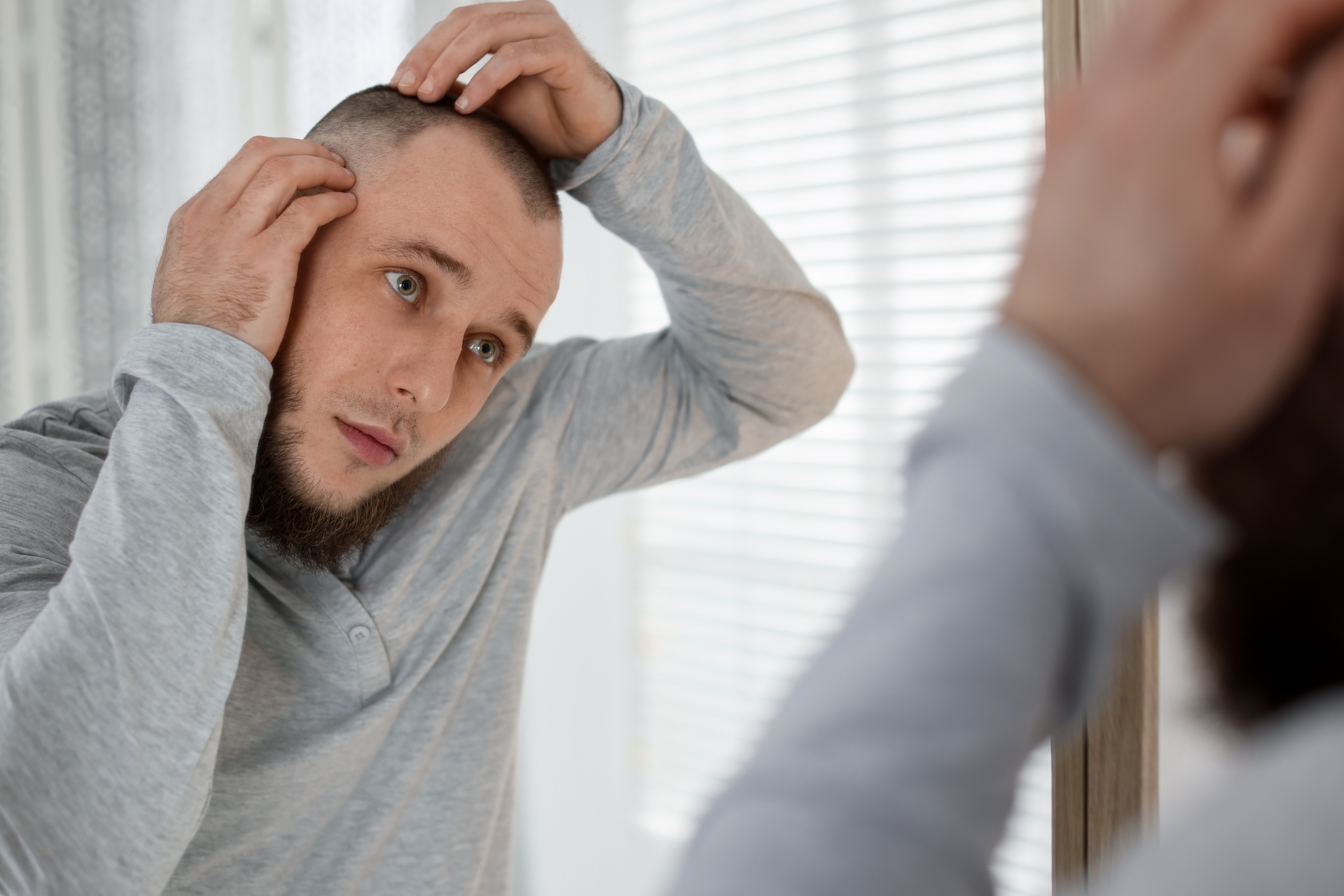 はげやすい人に特徴はある？