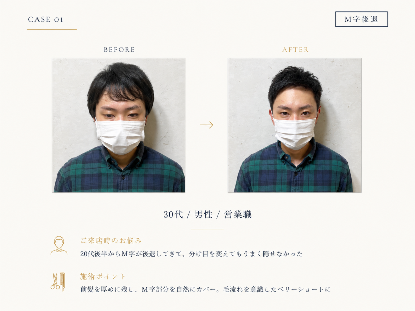 M字後退（薄毛）の30代男性のBefore/After｜RELIVEのカット事例