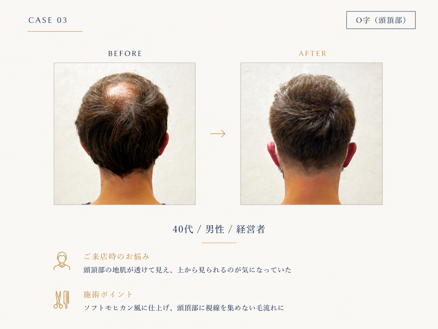 O字(頭頂部の薄毛)の40代男性のBefore/After｜RELIVEのカット事例
