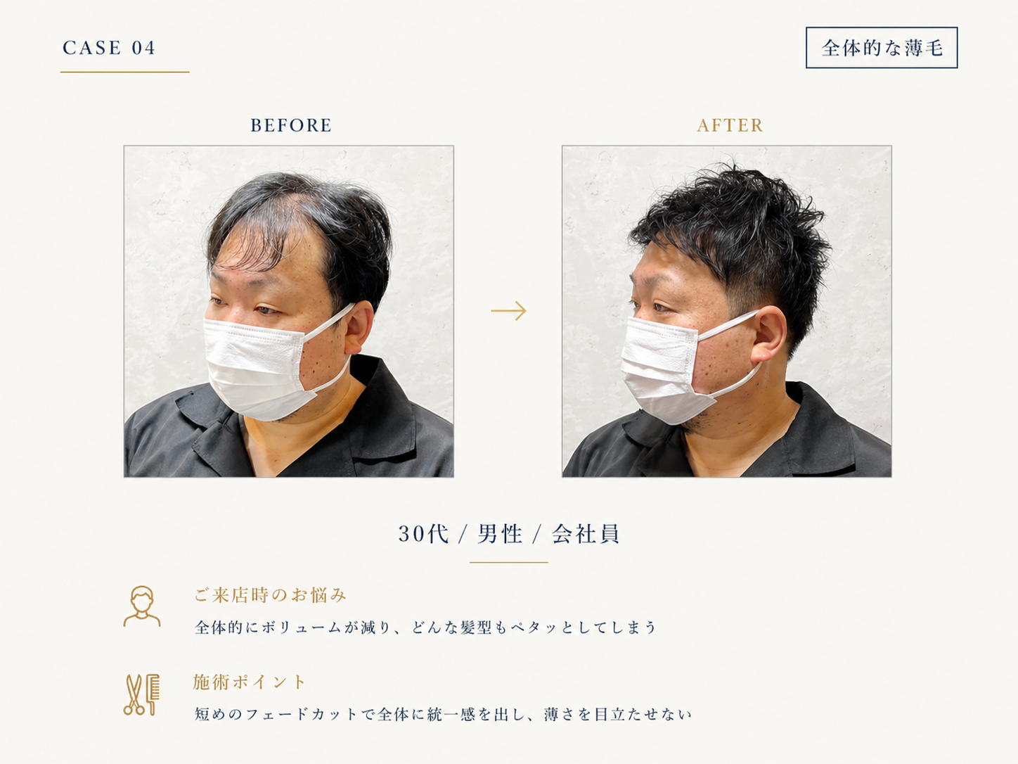 全体的な薄毛・ボリューム不足の30代男性のBefore/After｜RELIVEのカット事例