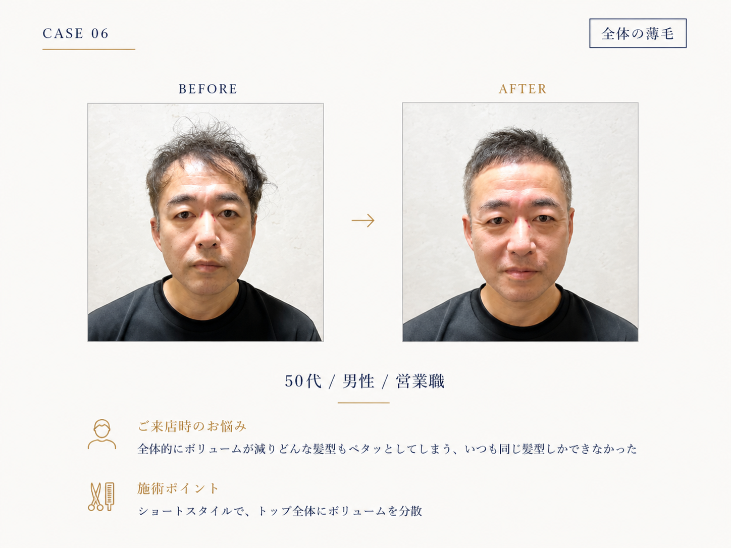 全体ボリューム不足の50代男性のBefore/After｜RELIVEのカット事例