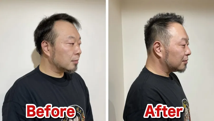 細軟髮扁塌側面剪髮前後對照案例