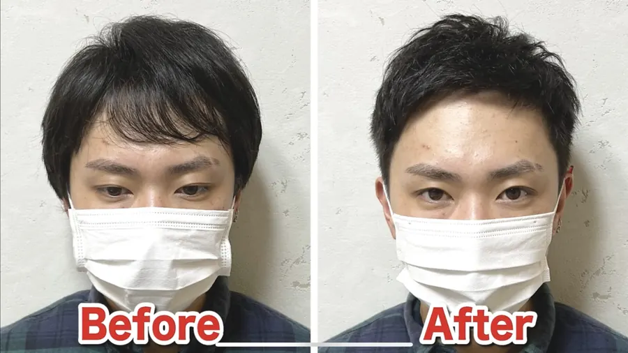 頭髮稀疏男生剪髮前後對照案例