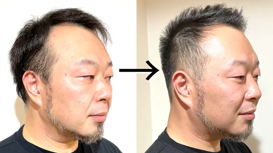 髮量少側面吹整造型前後對照