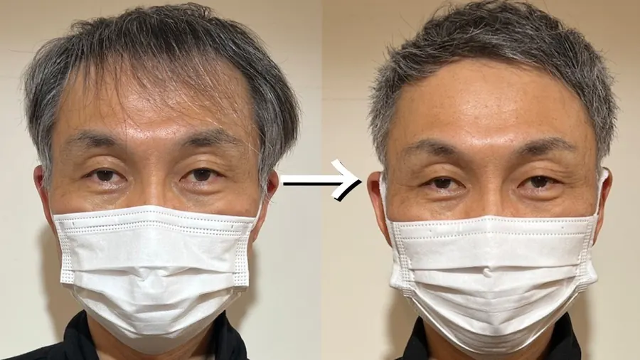 超短髮的改造前後對照