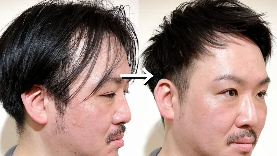 兩側推高短髮的改造前後對照