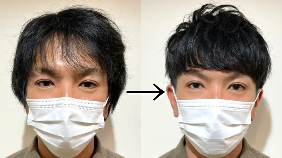 短版蓋頭的改造前後對照