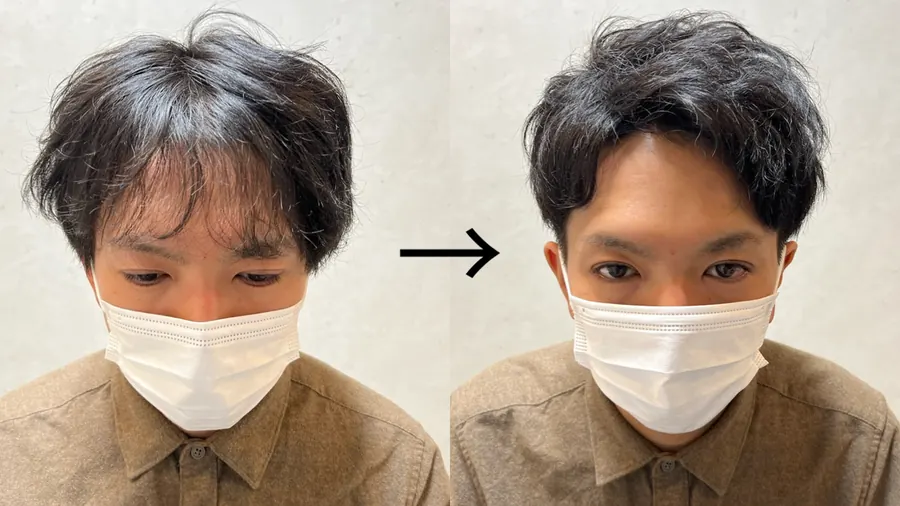 上梳瀏海的改造前後對照