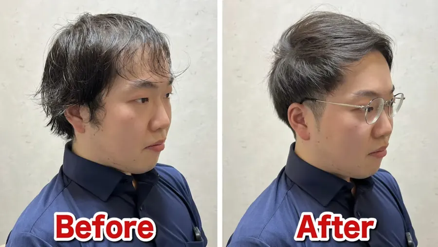 兩側推高的側面對照