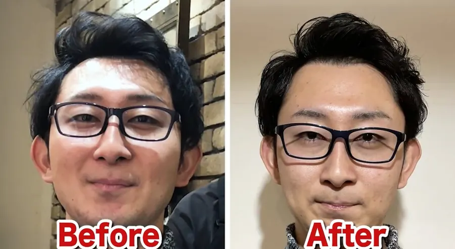 三七分修飾40歲稀疏的改造案例