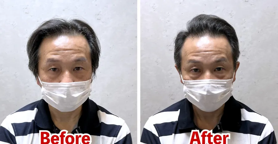 後梳油頭的改造前後對照