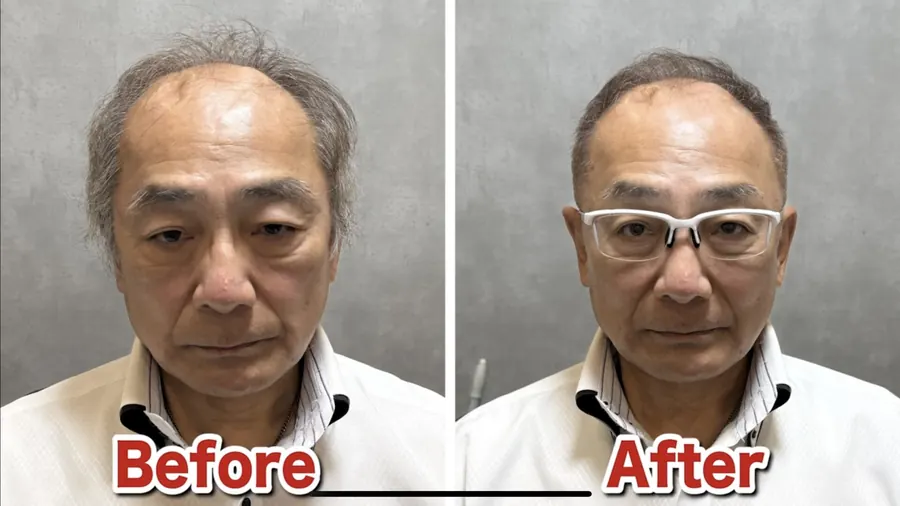 利用視覺效果讓稀疏不明顯