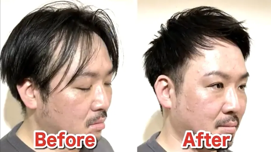 兩側推高短髮修飾M型禿與長臉