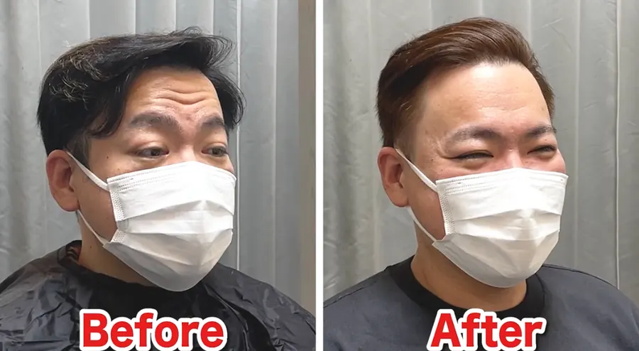 後梳油頭修飾M型禿