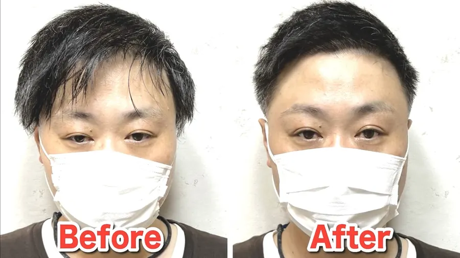 上梳瀏海短髮修飾M型禿
