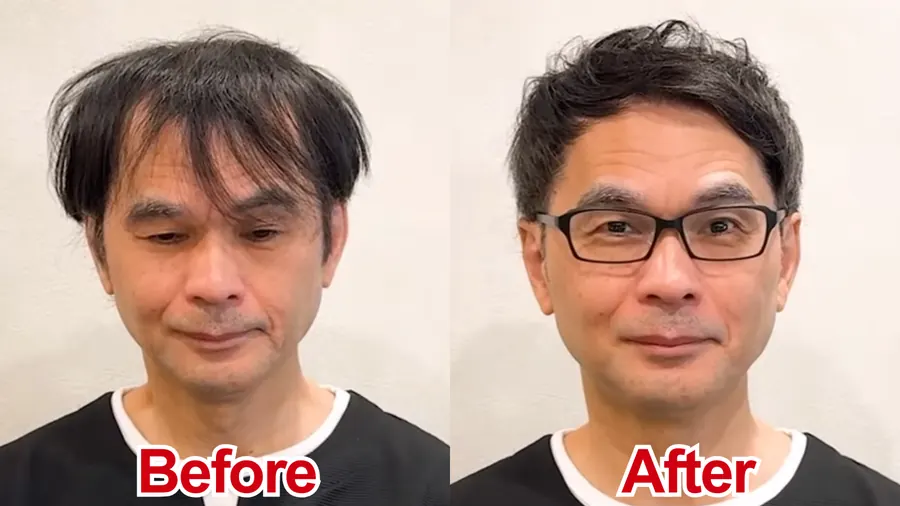 把兩側剪短讓M型不明顯