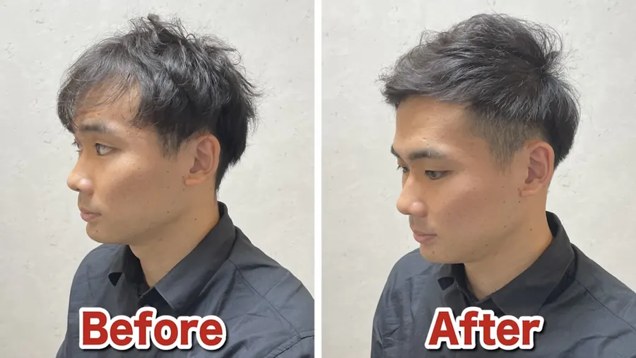 短髮讓M型禿不明顯