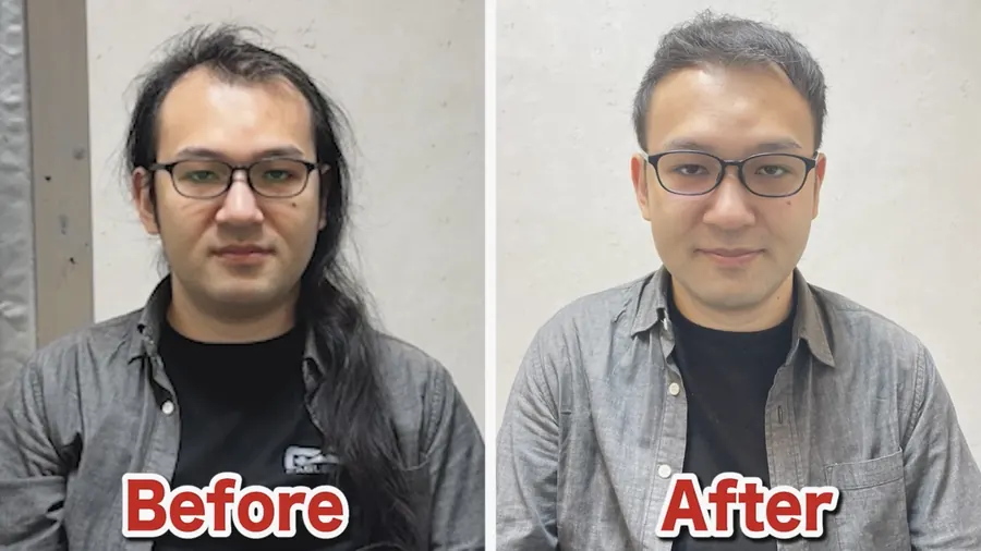 長髮讓M型禿更明顯
