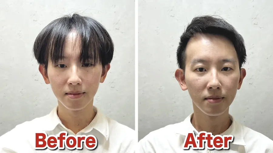 鍋蓋頭讓M型禿更明顯