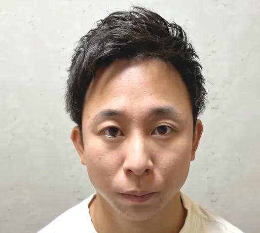 厚重的蓋頭會把頭頂壓平，稀疏反而更明顯。