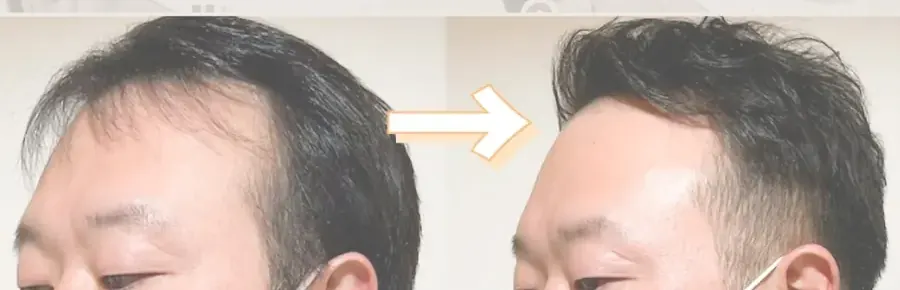 另一位的燙髮改造前後