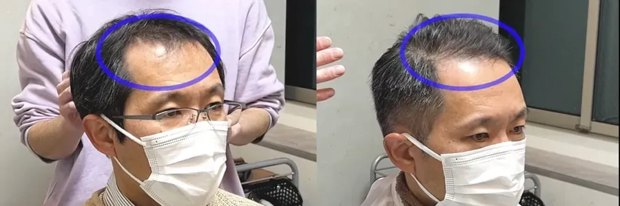 髮根壓平與立起來的比較