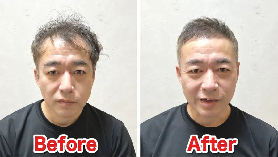 兩側收乾淨之後輪廓的變化