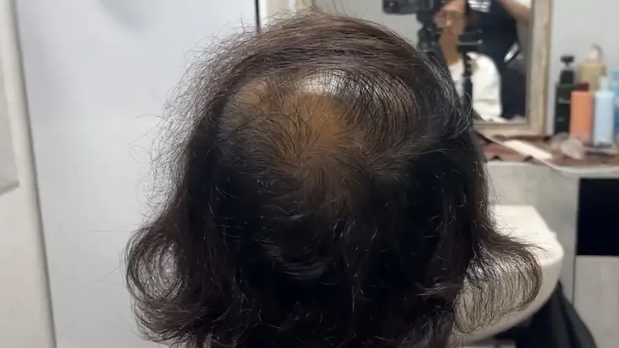 從正上方看髮旋