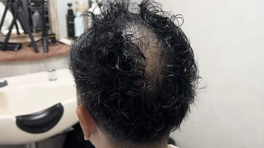 從後上方看頭頂