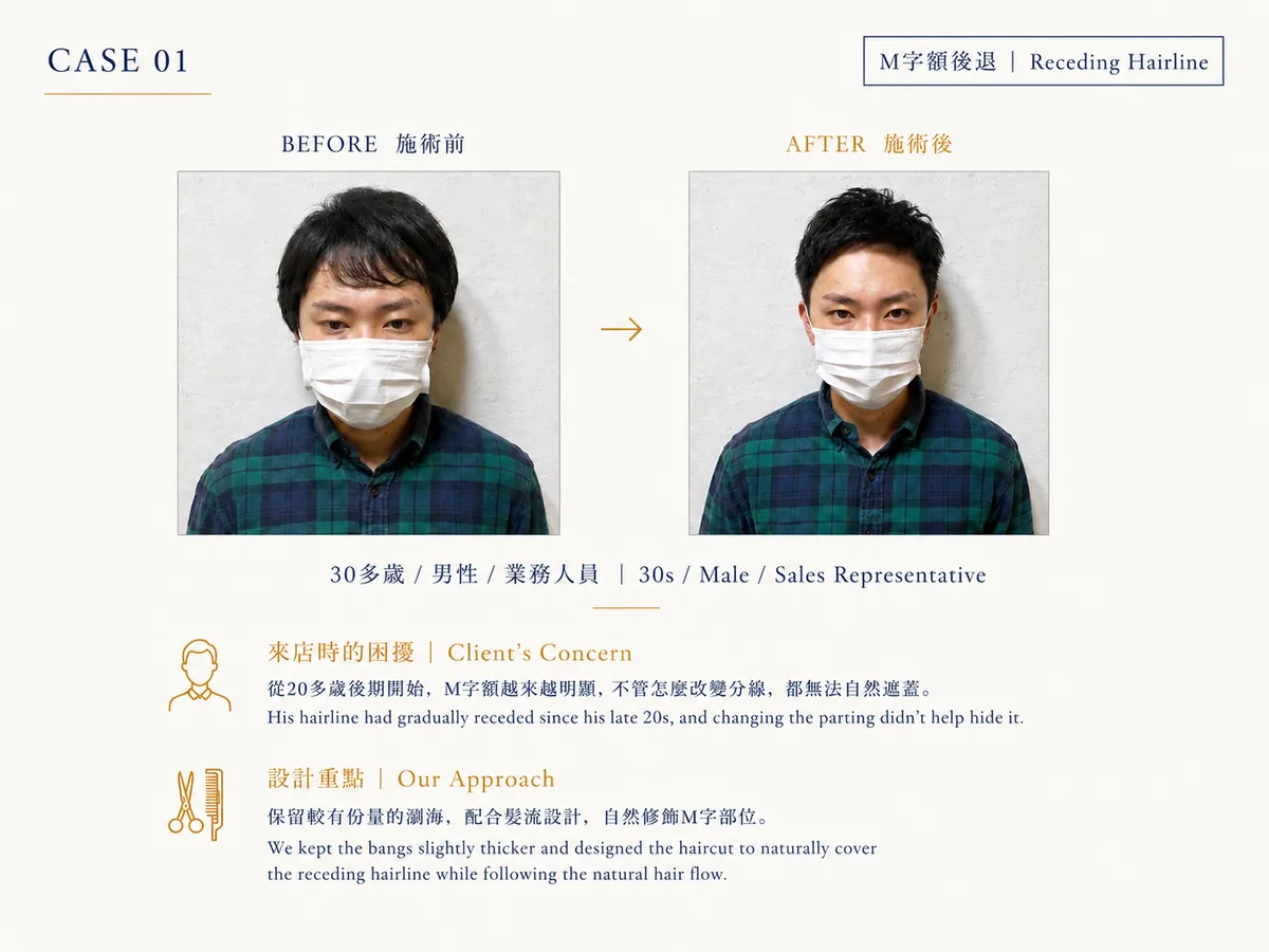 改造案例 CASE01：M字髮際線後退（30代男性）Before / After