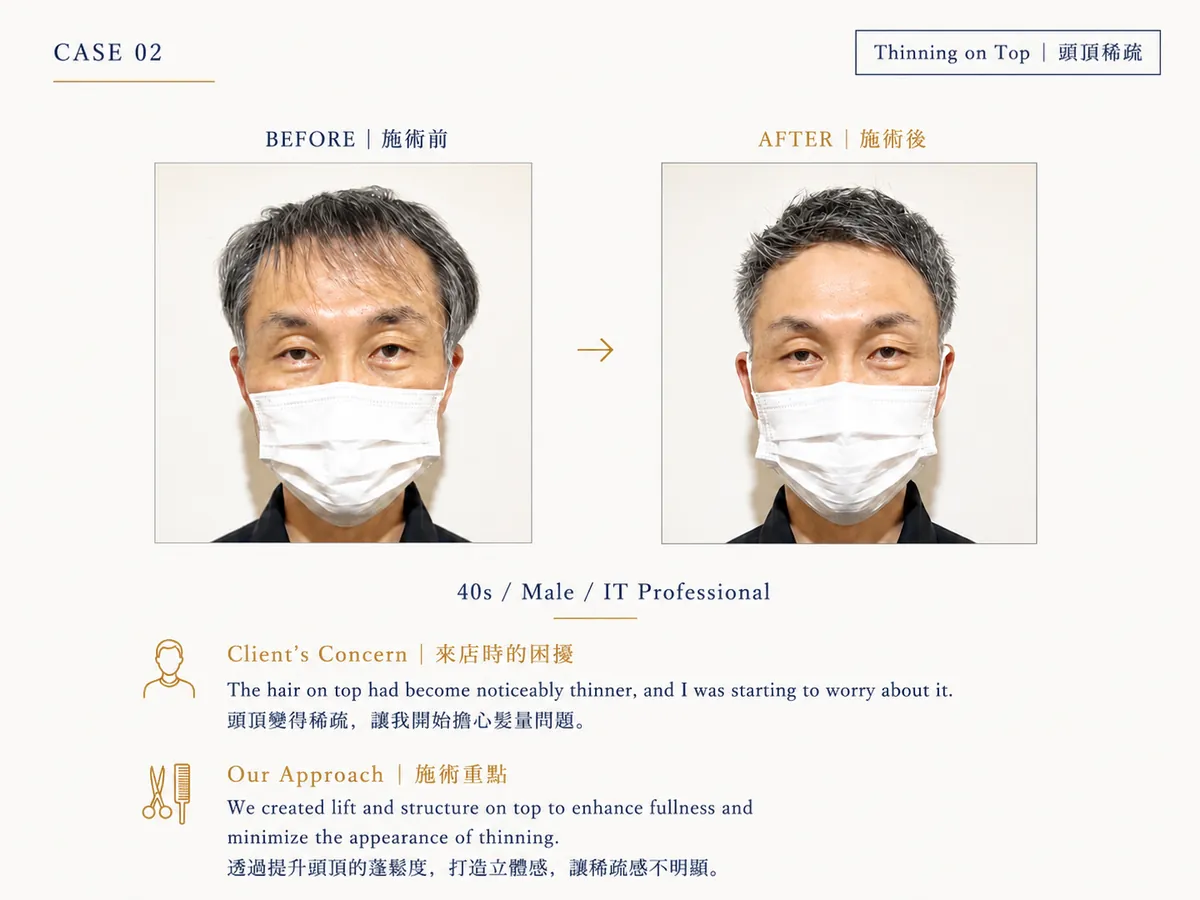 改造案例 CASE02：頭頂稀疏（40代男性）Before / After