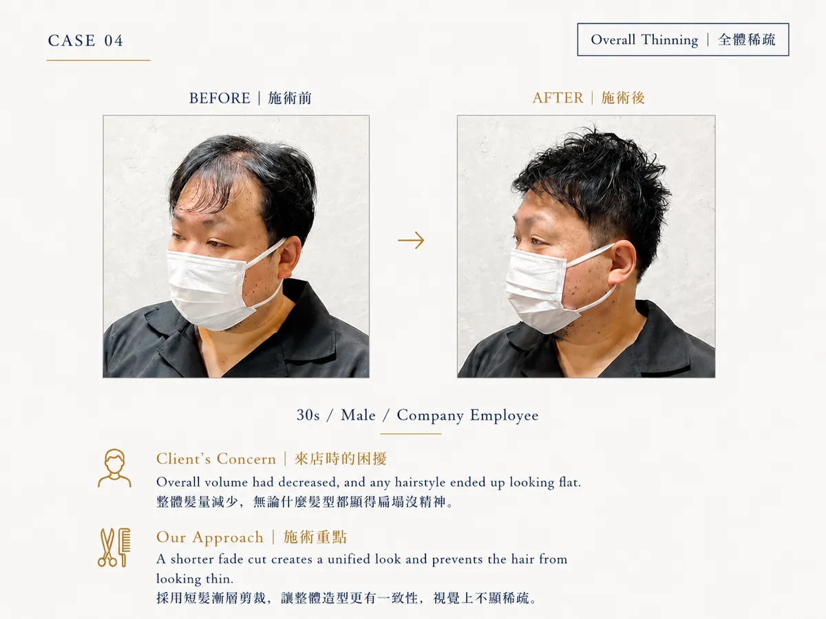 改造案例 CASE04：整體稀疏（30代男性）Before / After