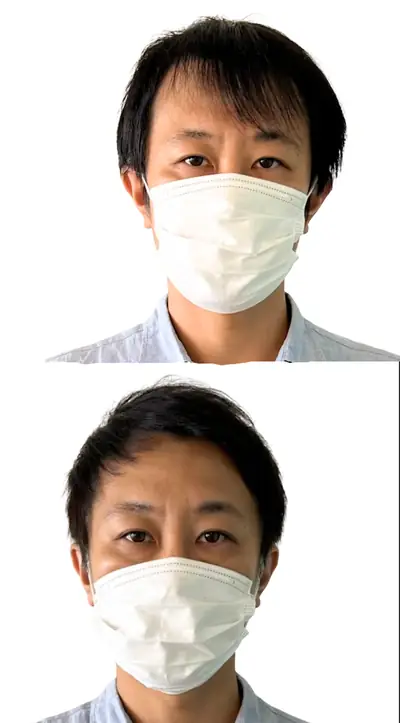 M型禿 × 兩側推高｜RELIVE JAPAN 頭髮稀疏專門剪髮案例