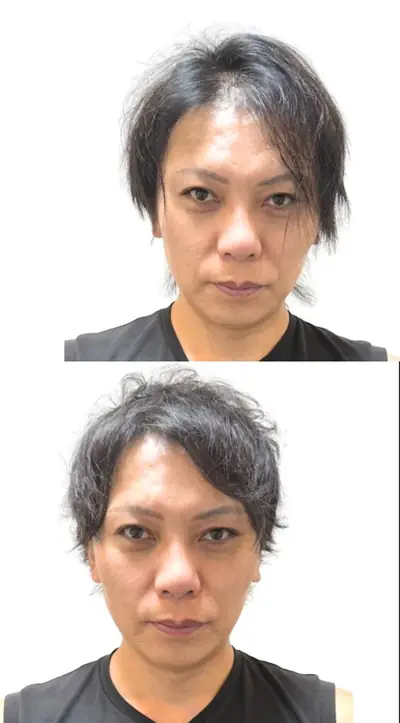 M型禿 × 上梳瀏海｜RELIVE JAPAN 頭髮稀疏專門剪髮案例