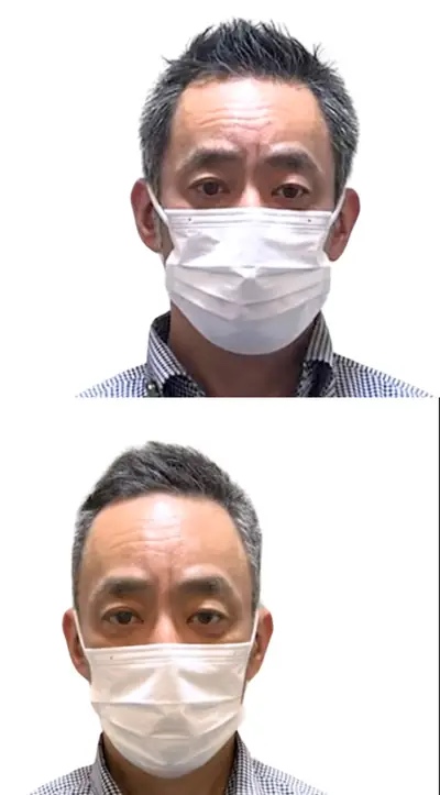 地中海禿 × 超短髮｜RELIVE JAPAN 頭髮稀疏專門剪髮案例