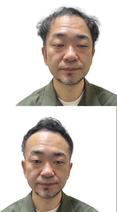 U型禿 × 頭頂立體短髮｜RELIVE JAPAN 頭髮稀疏專門剪髮案例