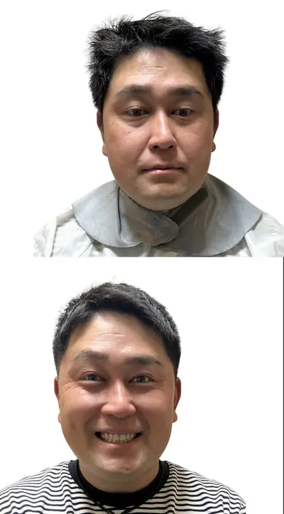 M型禿 × 上梳瀏海｜RELIVE JAPAN 頭髮稀疏專門剪髮案例