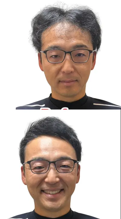 M型禿 × 短髮｜RELIVE JAPAN 頭髮稀疏專門剪髮案例