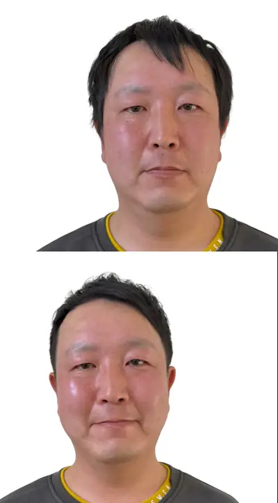 M型禿 × 推剪｜RELIVE JAPAN 頭髮稀疏專門剪髮案例
