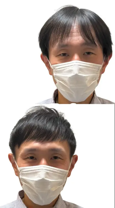 M型禿 × 短髮｜RELIVE JAPAN 頭髮稀疏專門剪髮案例