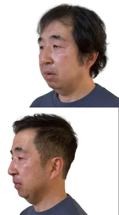 M型禿 × 超短髮｜RELIVE JAPAN 頭髮稀疏專門剪髮案例